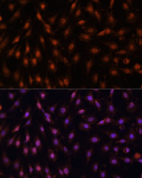 P70 S6K Antibody