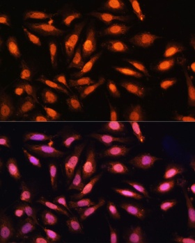 P70 S6K Antibody