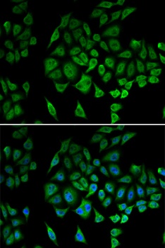 NDUFS1 Antibody