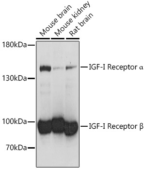 IGF1R Antibody