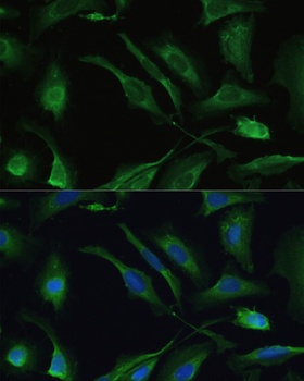 IL18 Antibody