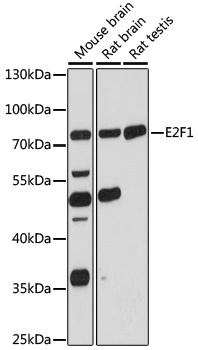 E2F1 Antibody