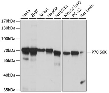 P70 S6K Antibody