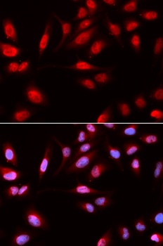 PDPK1 Antibody