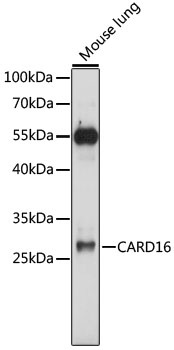 CARD16 Antibody