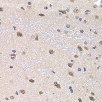 PTHLH Antibody