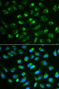 IL7 Antibody