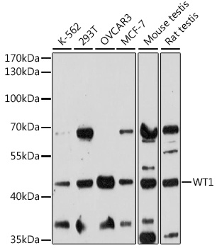 WT1 Antibody