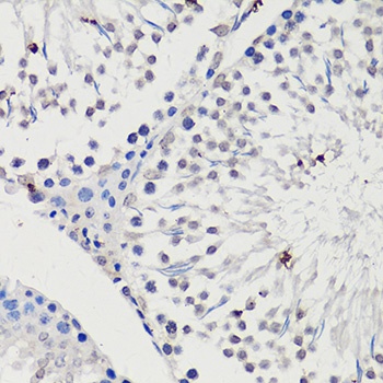 WT1 Antibody