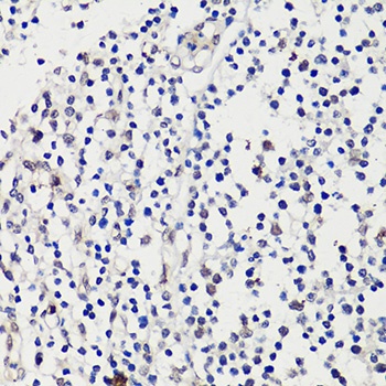 WT1 Antibody