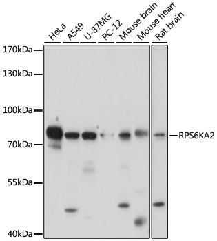 RPS6KA2 Antibody