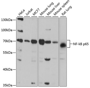 NF-kB p65 Antibody