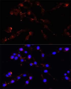VDAC1 / Porin Antibody