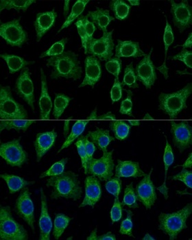 TSPO Antibody