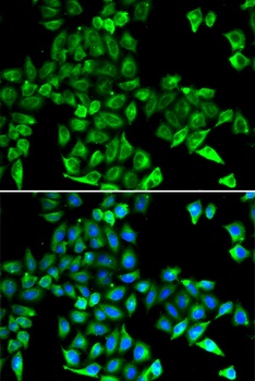 CST3 Antibody