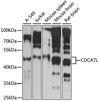 CDCA7L Antibody