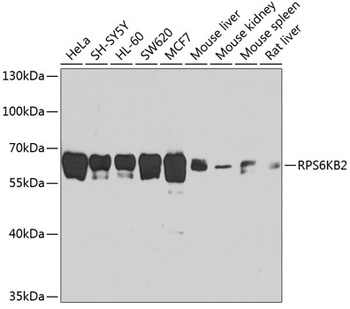 RPS6KB2 Antibody