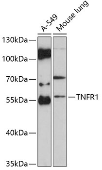 TNFR1 Antibody