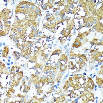TNFR1 Antibody
