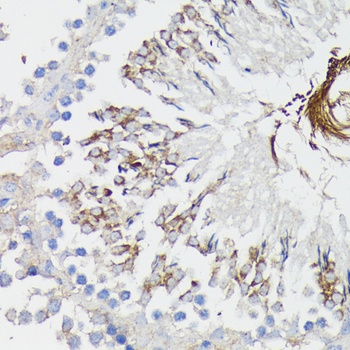 TNFR1 Antibody