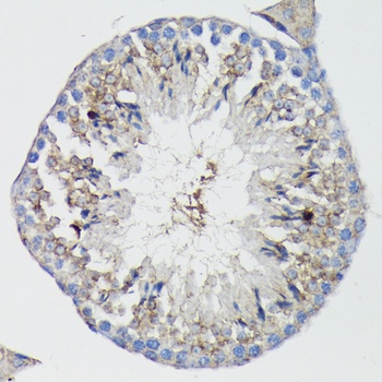 TNFR1 Antibody