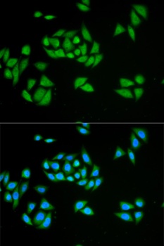 UPF1 Antibody