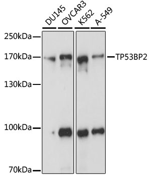 TP53BP2 Antibody