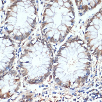 HSPA1A Antibody [1B10F3]