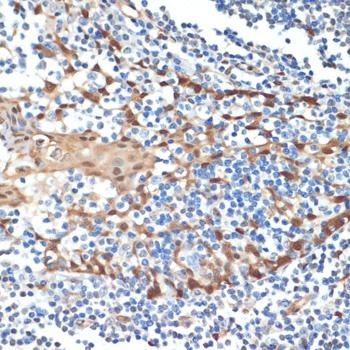 HSPA1A Antibody [1B10F3]