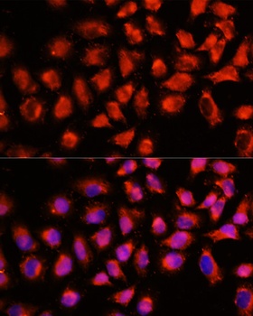 ADAM8 Antibody