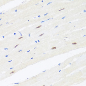 BRMS1 Antibody