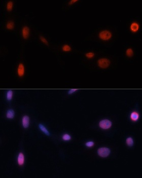 CDKN1A Antibody
