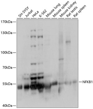 NFKB1 Antibody