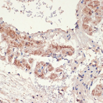 ADRA1A Antibody