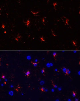 GFAP Antibody