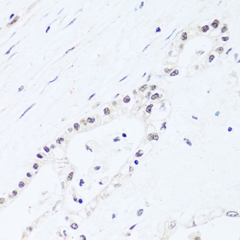 BRIX1 Antibody