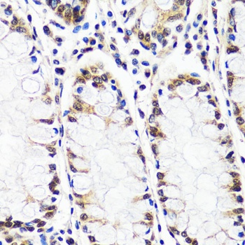 CAND1 Antibody