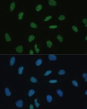 MKL1 Antibody