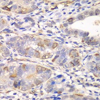 GCLM Antibody