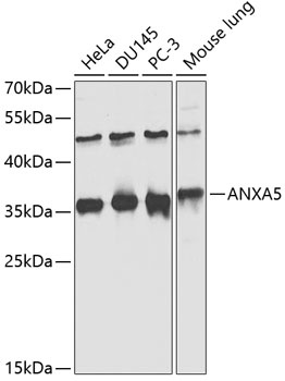 ANXA5 Antibody