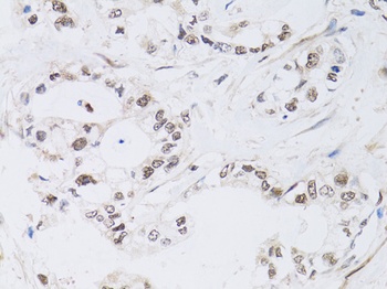 PAX3 Antibody