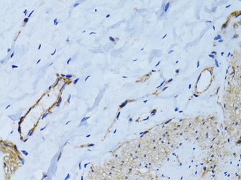 MCAM Antibody