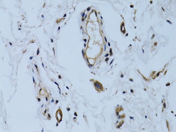 MCAM Antibody
