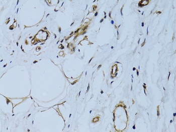 MCAM Antibody