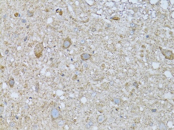 PHLDA2 Antibody