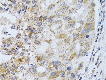 PHLDA2 Antibody