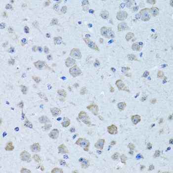 KNG1 Antibody