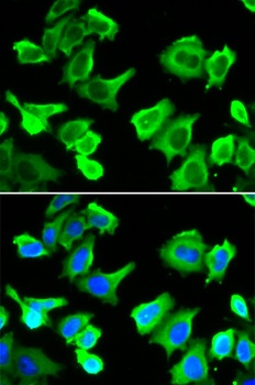 HSPB1 Antibody