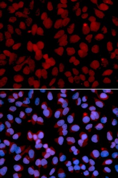 TNFAIP3 Antibody