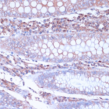CD38 Antibody
